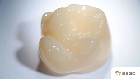 VarseoSmile Crown plus