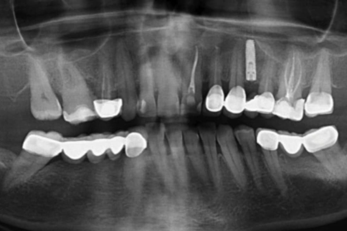 Klinik ve Estetik Sonuçlar