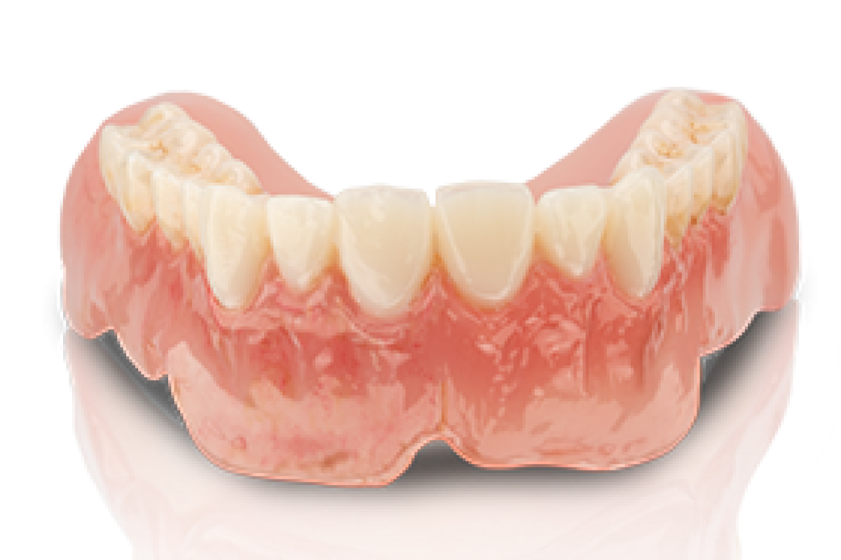 imgIndikationen_3D-Druck-start_140x140_Teeth_01